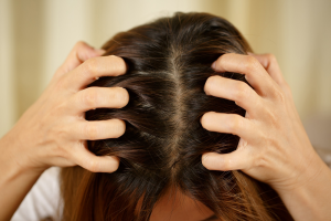 Itchy and Oily Scalp: An Overview